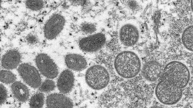 This 2003 electron microscope image made available by the Centers for Disease Control and...